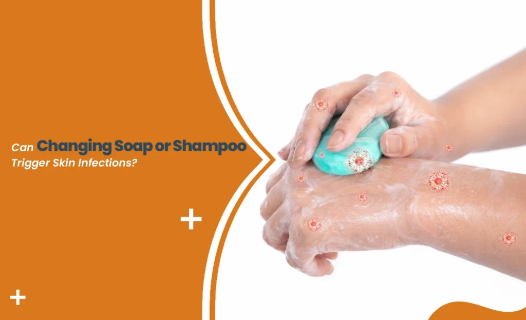 Changing soap trigger skin infection shown with hands washing and visible irritation spots on skin