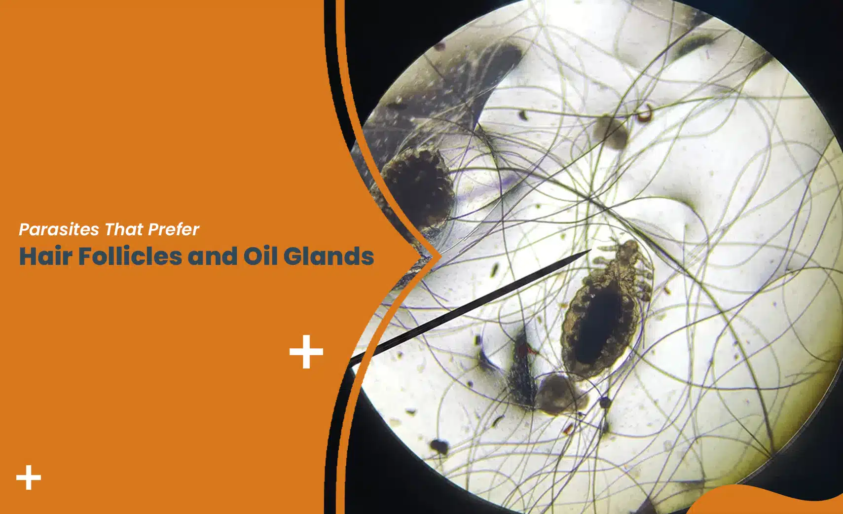 Demodex mites in hair follicles under microscope showing parasites in oil glands