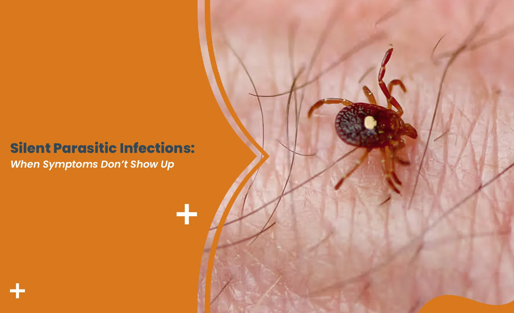 Close-up tick on human skin representing Silent Parasitic Infections that often show no symptoms.