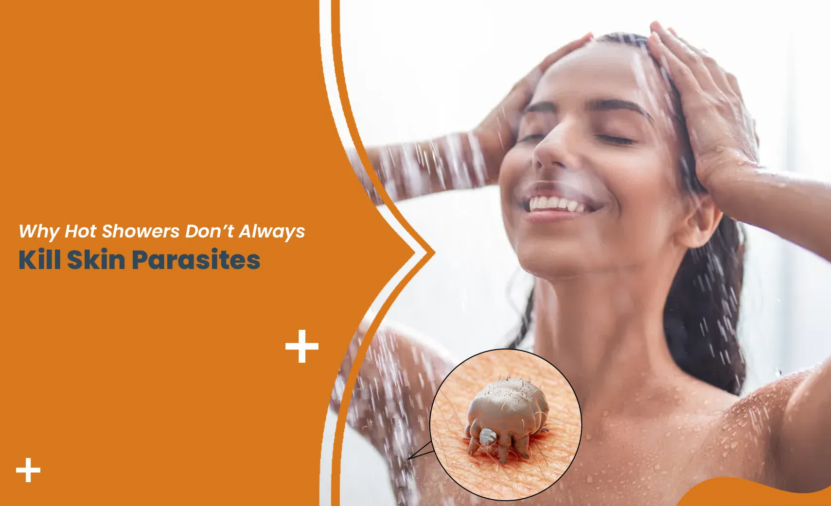 Hot showers don’t kill skin parasites – woman showering illustrating why heat cannot eliminate skin mites and parasites