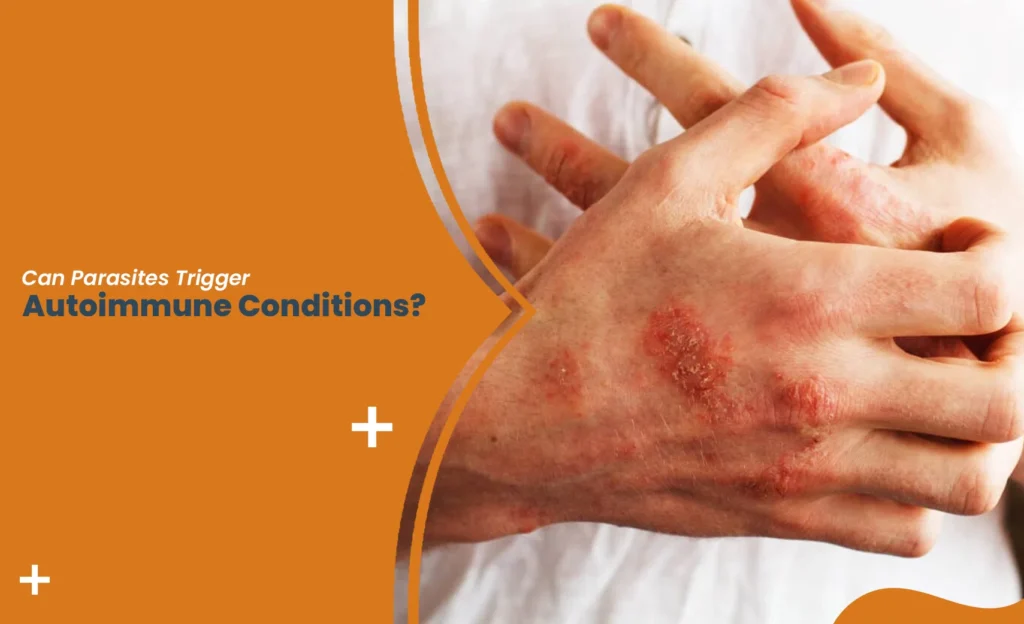 Parasites and autoimmune disease causing skin rash and inflammation on hand