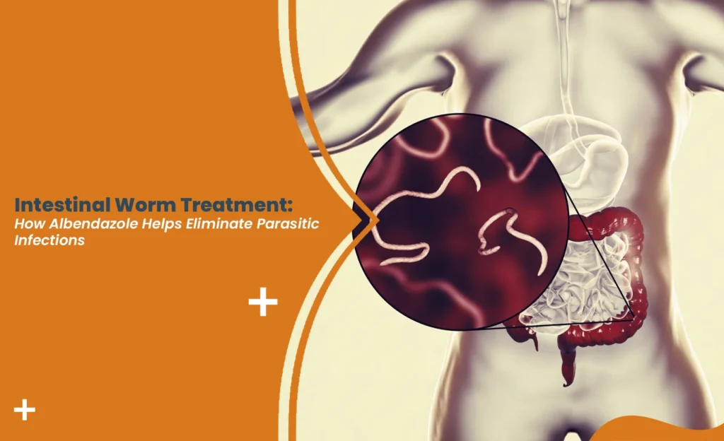 Intestinal Worm Treatment illustration showing parasitic worms in the human intestine and how Albendazole helps eliminate intestinal worm infections.