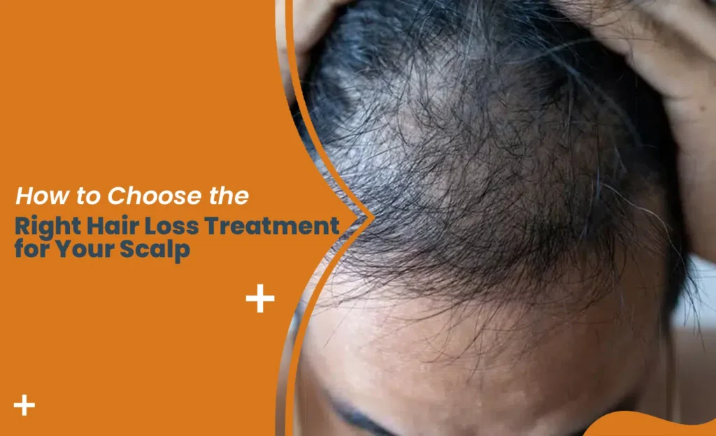 Man checking thinning hair on scalp — guide to choosing the right hair loss treatment