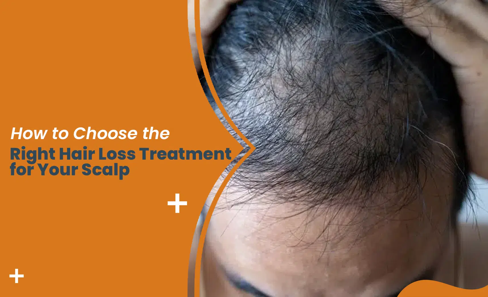 Man checking thinning hair on scalp — guide to choosing the right hair loss treatment