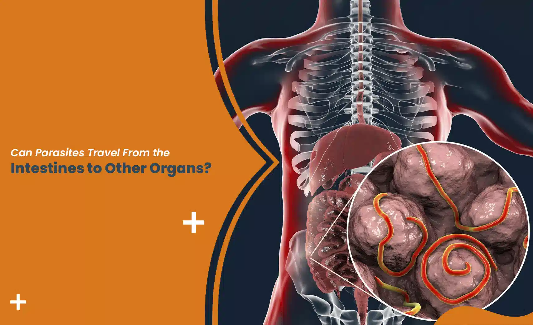 Illustration of parasites in the intestines that can travel to other organs like the liver in the human body