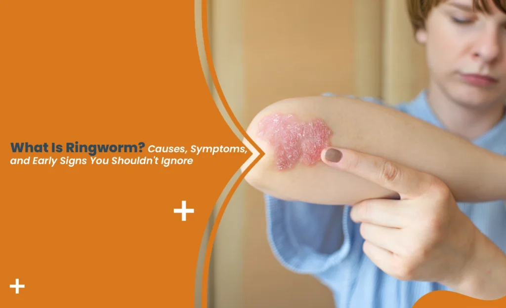 Ringworm skin rash showing early signs and symptoms on the arm